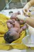 220px-Umbilical-newborn